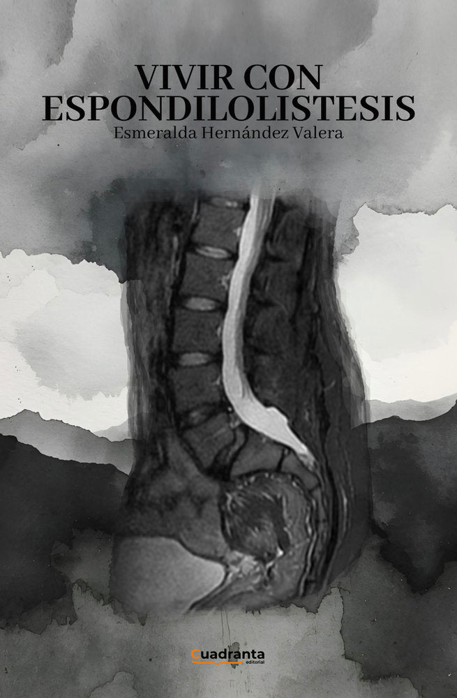 Vivir con espondilolistesis