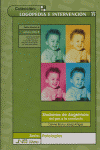 S�ndrome de Angelman: del gen a la conducta